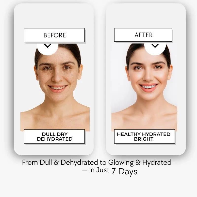 Before and after comparison of a woman&