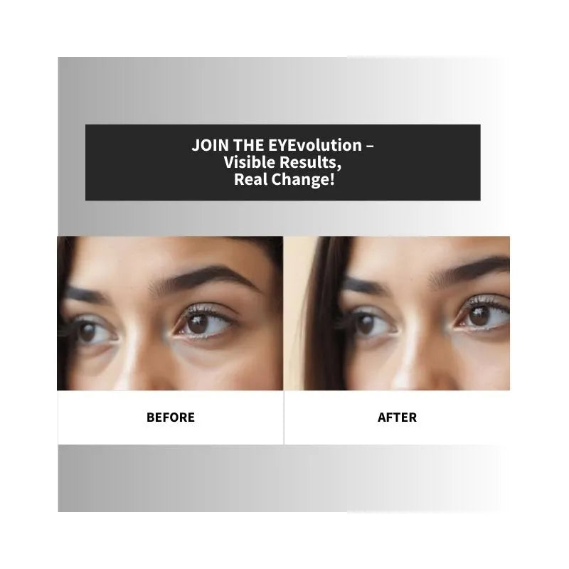 Rejuvenix Under Eye Gel For Reducing Dark Circles And Puffiness with Advanced Actives (Lightweight)